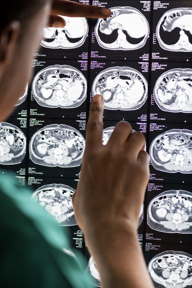 Doctor reading brain MRI x-ray result Scanner vétérinaire à Liège - Umanimo